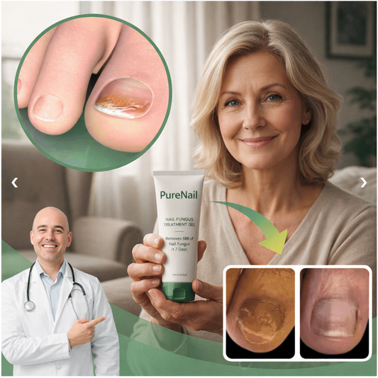 PureNail Nagelbehandeling Tar bort 98 % av nagelsvampen på 7 dagar!