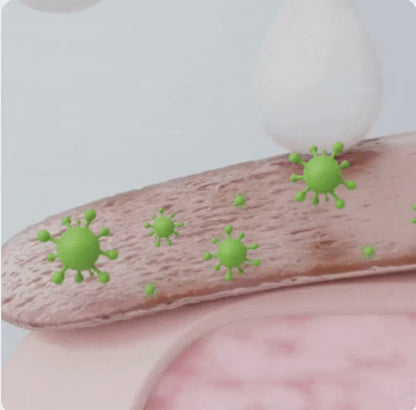 NagelFix svampspray 99 % av nagelsvampen borta på 7 dagar!